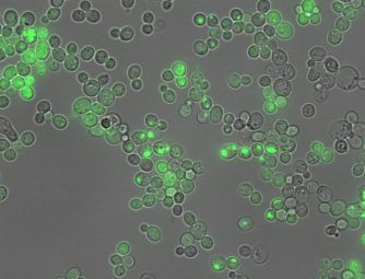 Una IA permite traducir el lenguaje de las proteínas vinculadas con el alzhéimer