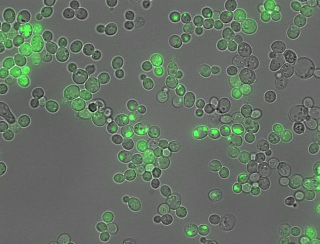 Una IA permite traducir el lenguaje de las proteínas vinculadas con el alzhéimer