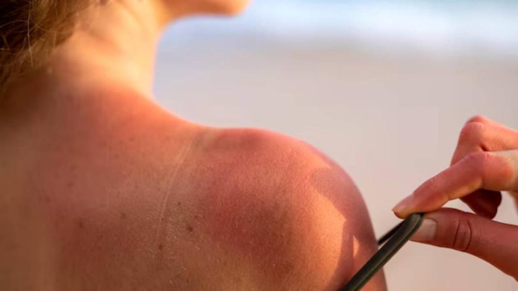 El calor, la sal y el cloro, enemigos invisibles de la piel en verano