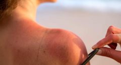 El calor, la sal y el cloro, enemigos invisibles de la piel en verano